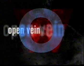 O for Open Vein